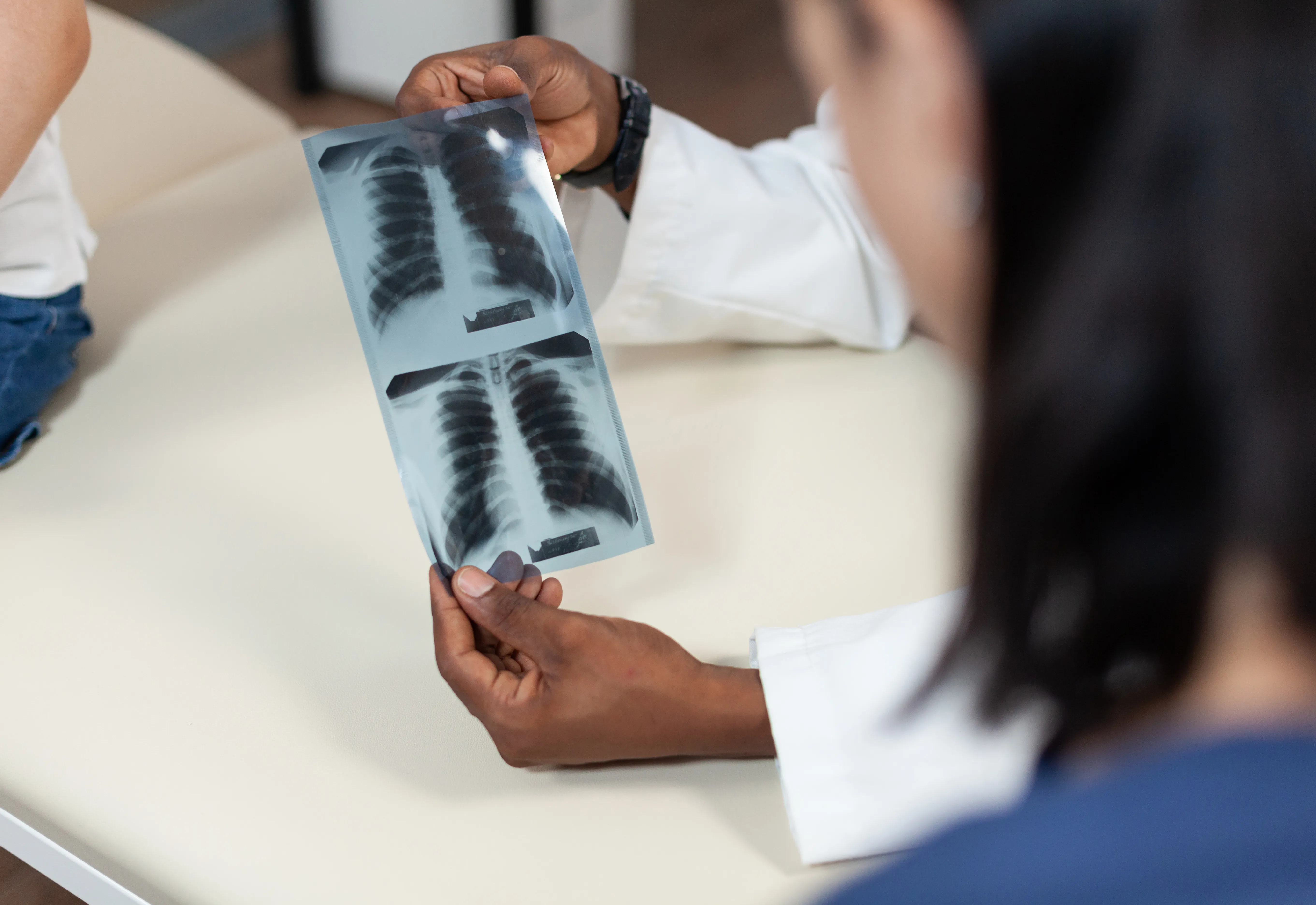 Saúde intensifica combate à Tuberculose em Botucatu