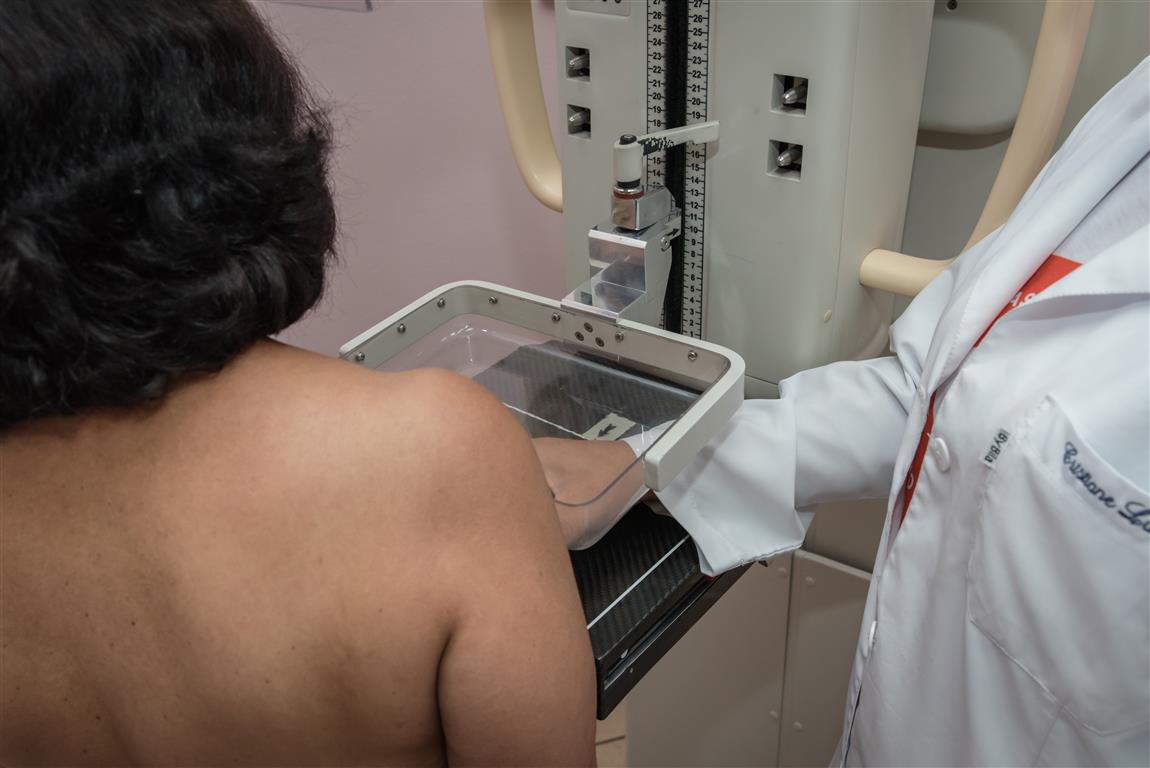 Botucatu terá carreta para exames de mamografia em agosto